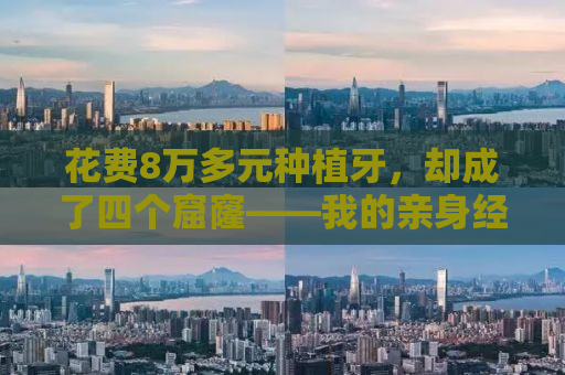 花费8万多元种植牙，却成了四个窟窿——我的亲身经历与反思
